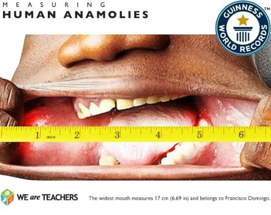 human-anamolies