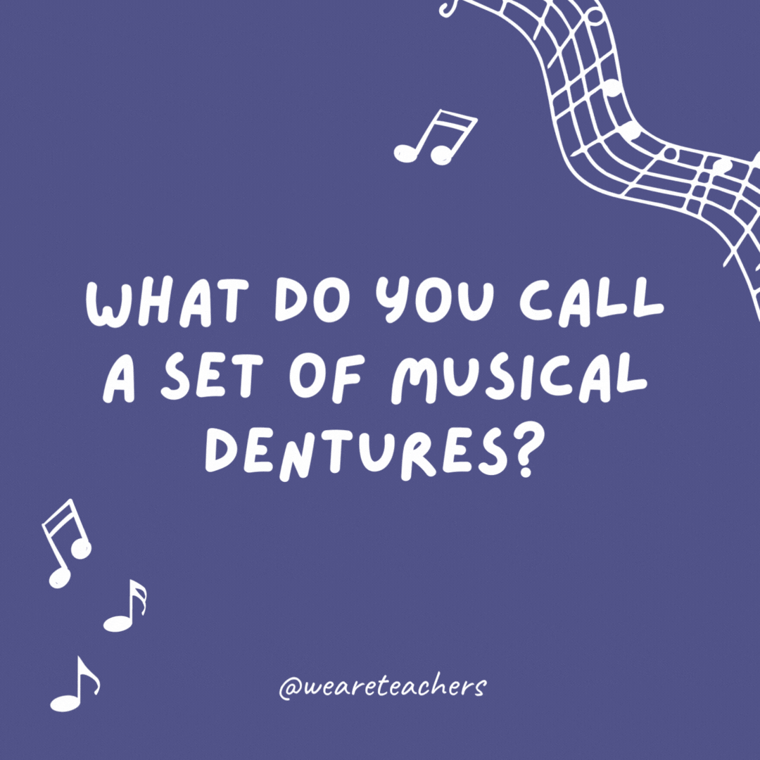 What do you call a set of musical dentures? Falsetto teeth.