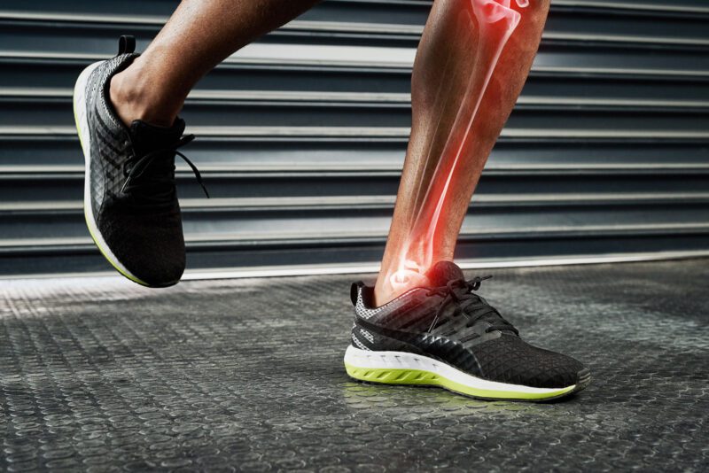 Closeup shot of an athlete's legs with cgi showing an inflammation in his tibia and fibula