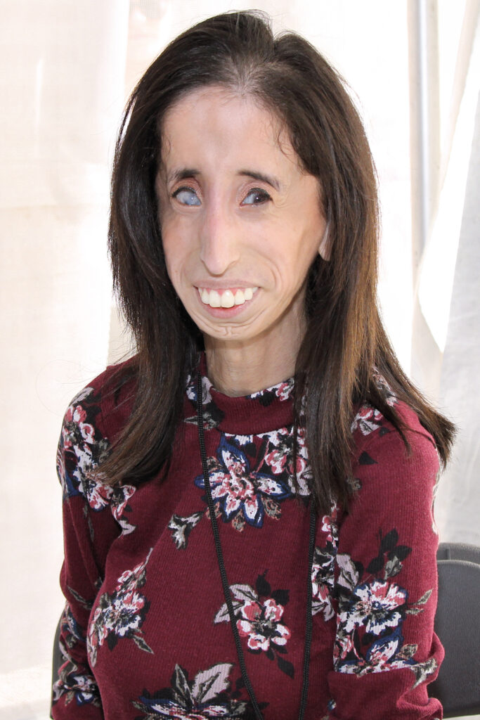 Lizzie Velasquez famous women in history