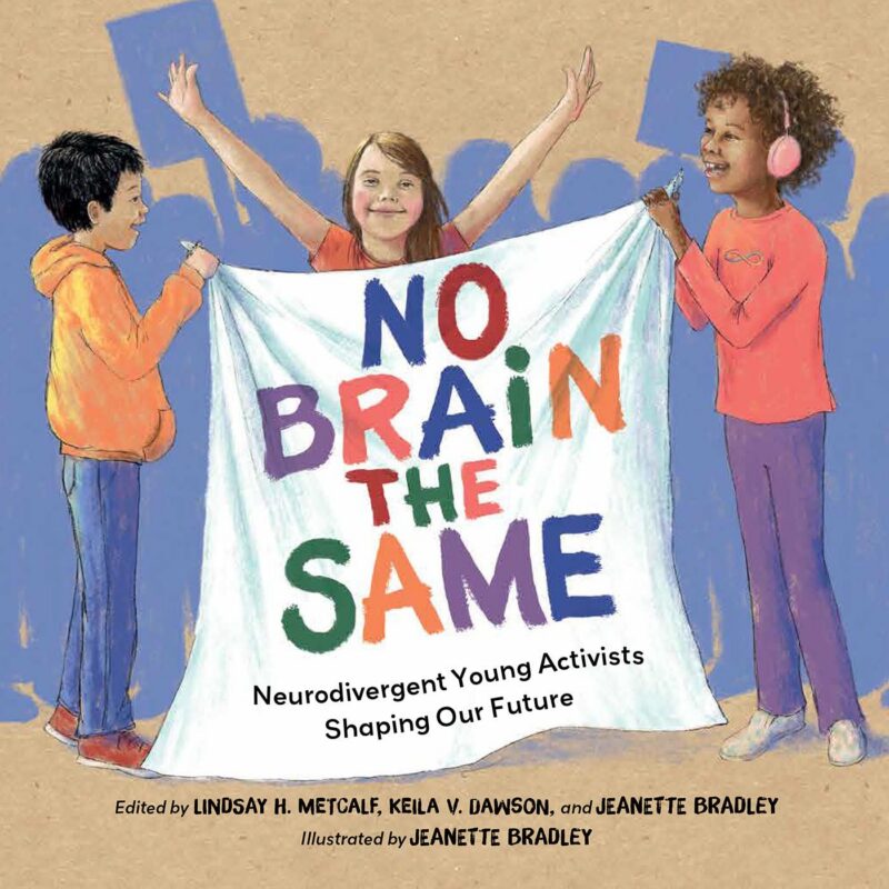 No Brain the Same book cover