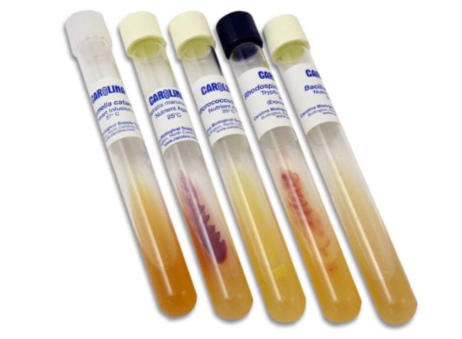 Test tubes containing various bacteria
