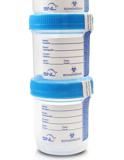 Stacked sterile specimen cups with blue plastic lids and labels